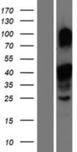Novus Biologicals™ MLX Overexpression Lysate