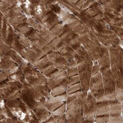 MLXIP Antibody, Novus Biologicals 25 &mu;L; Unlabeled:Antibodies, Polyclonal