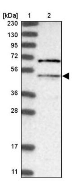 MLYCD Antibody, Novus Biologicals 0.1mL; Unlabeled:Antibodies, Polyclonal