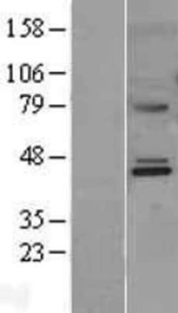 Novus Biologicals™ MMAA Overexpression Lysate