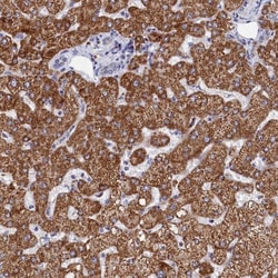 FTSJ1 Antibody, Novus Biologicals:Antibodies:Primary Antibodies