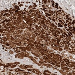 Caldesmon/CALD1 Antibody, Novus Biologicals:Antibodies:Primary Antibodies