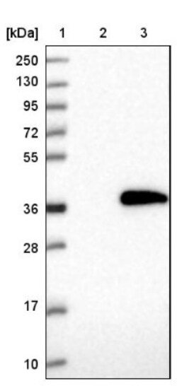 MMADHC Antibody, Novus Biologicals 25 &mu;L; Unlabeled:Antibodies, Polyclonal