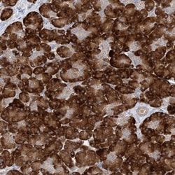 MMADHC Antibody, Novus Biologicals 25 &mu;L; Unlabeled:Antibodies, Polyclonal