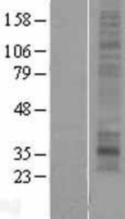 Novus Biologicals&trade;&nbsp;MMD2 Overexpression Lysate