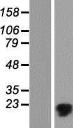 Novus Biologicals&trade;&nbsp;MMGT1 Overexpression Lysate