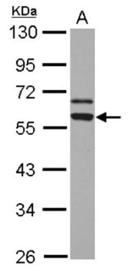 MMP-10 Antibody, Novus Biologicals 0.1mL; Unlabeled:Antibodies, Polyclonal