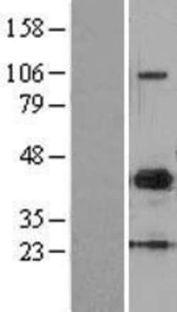 Novus Biologicals™ MMP-10 Overexpression Lysate