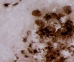 MMP-12 Antibody (703D10), Novus Biologicals 0.1mg; Unlabeled:Antibodies,
