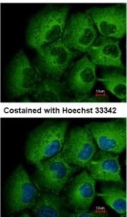 MMP-12 Antibody, Novus Biologicals 0.1mg; Unlabeled:Antibodies, Polyclonal