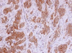 MMP-12 Antibody, Novus Biologicals 0.1mg; Unlabeled:Antibodies, Polyclonal
