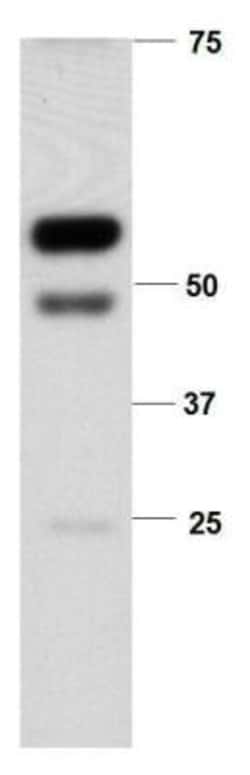 MMP-12 Antibody, Novus Biologicals 0.1mg; Unlabeled:Antibodies, Polyclonal