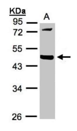 MMP-12 Antibody, Novus Biologicals 0.1mg; Unlabeled:Antibodies, Polyclonal