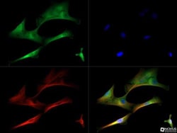 MMP-13 Antibody, Novus Biologicals:Antibodies:Primary Antibodies