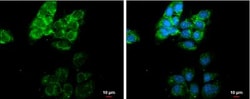 MMP-13 Antibody, Novus Biologicals 0.1mL; Unlabeled:Antibodies, Polyclonal