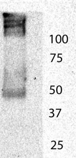MMP-13 Antibody, Novus Biologicals:Antibodies:Primary Antibodies