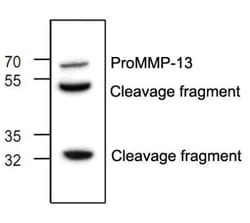 MMP-13 Antibody, Novus Biologicals:Antibodies:Primary Antibodies