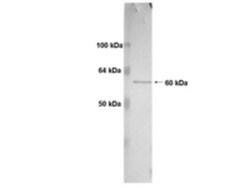 MMP-14/MT1-MMP Antibody (3G4.2) - BSA Free, Novus Biologicals:Antibodies:Primary