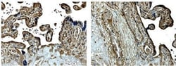 MMP-14/MT1-MMP Antibody (MM0027-9E10) - Azide and BSA Free, Novus Biologicals