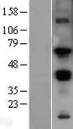 Novus Biologicals&trade;&nbsp;MMP-14/MT1-MMP Overexpression Lysate