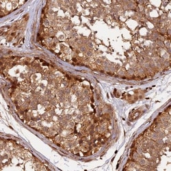 MMP-15/MT2-MMP Antibody, Novus Biologicals:Antibodies:Primary Antibodies