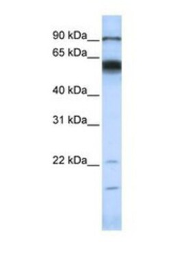 MMP-16/MT3-MMP Antibody, Novus Biologicals 0.05mg; Unlabeled:Antibodies,