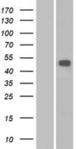 Novus Biologicals&trade;&nbsp;MMP-16/MT3-MMP Overexpression Lysate