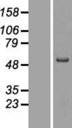 Novus Biologicals&trade;&nbsp;MMP-19 Overexpression Lysate