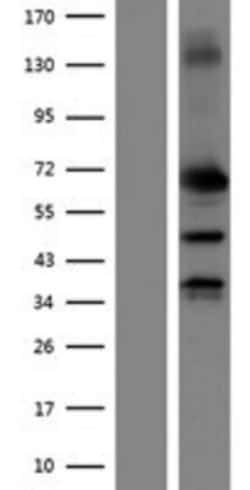 Novus Biologicals&trade;&nbsp;MMP-2 Overexpression Lysate