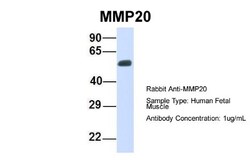 MMP20 Antibody, Novus Biologicals:Antibodies:Primary Antibodies