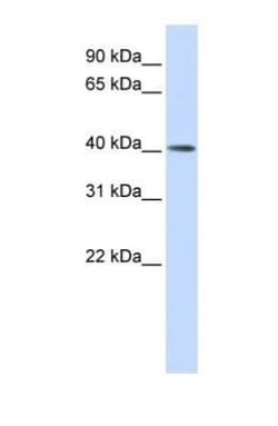 MMP20 Antibody, Novus Biologicals:Antibodies:Primary Antibodies