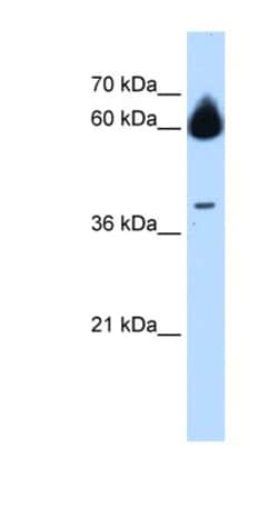 MMP23B Antibody, Novus Biologicals 100 &mu;L | Buy Online | Novus Biologicals | Fisher Scientific