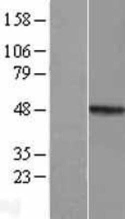 Novus Biologicals™ MMP23B Overexpression Lysate