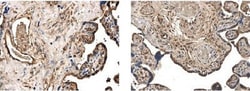 MMP-25/MT6-MMP Antibody (MM0029-2B5) - Azide and BSA Free, Novus Biologicals:Antibodies:Primary