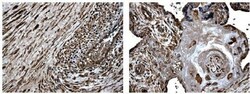 MMP-8 Antibody (MM0023-7A11) - Azide and BSA Free, Novus Biologicals 0.1