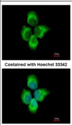 MMP-8 Antibody, Novus Biologicals 0.1mL; Unlabeled:Antibodies, Polyclonal