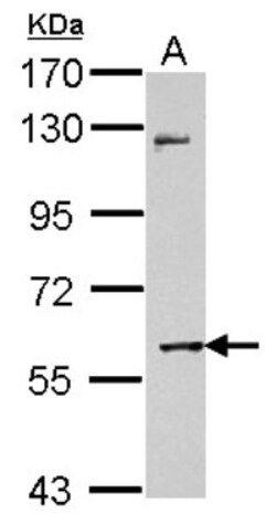 MMP-8 Antibody, Novus Biologicals 0.1mL; Unlabeled:Antibodies, Polyclonal