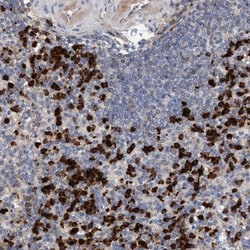MMP-8 Antibody, Novus Biologicals 0.1mL; Unlabeled:Antibodies, Polyclonal
