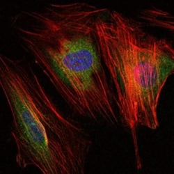 MMP-9 Antibody (5G3), Novus Biologicals 0.1mL; Unlabeled:Antibodies, Monoclonal