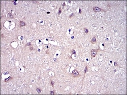 MMP-9 Antibody (5G3), Novus Biologicals 0.1mL; Unlabeled:Antibodies, Monoclonal