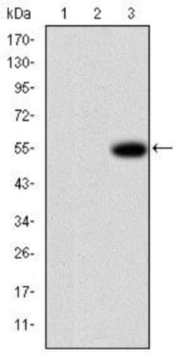 MMP-9 Antibody (5G3), Novus Biologicals 0.1mL; Unlabeled:Antibodies, Monoclonal