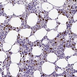 MMP-9 Antibody, Novus Biologicals 0.1mL; Unlabeled:Antibodies, Polyclonal