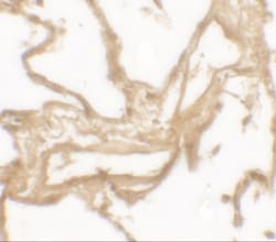 MMP-9 Antibody - BSA Free, Novus Biologicals 0.025 mg, Unlabeled:Antibodies,