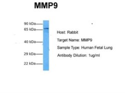 MMP-9 Antibody - BSA Free, Novus Biologicals 0.025 mg, Unconjugated:Antibodies,