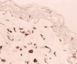 MMR/CD206/Mannose Receptor Antibody (122D2.08), Novus Biologicals 0.1mg;