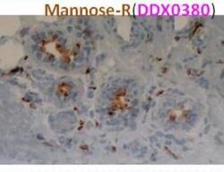 MMR/CD206/Mannose Receptor Antibody (122D2.08), Novus Biologicals 0.1mg;