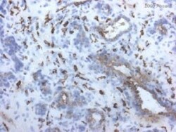 MMR/CD206/Mannose Receptor Antibody (15-2), Novus Biologicals 0.05mg; Unlabeled:Antibodies,