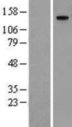 Novus Biologicals™ MMRN1 Overexpression Lysate