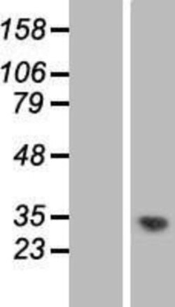 Novus Biologicals™ MMTAG2 Overexpression Lysate