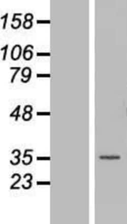 Novus Biologicals&trade;&nbsp;MNAT1 Overexpression Lysate